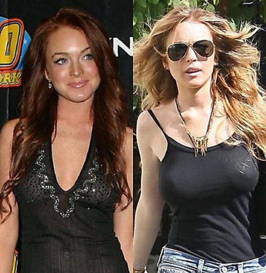 Lyndsey Lohan Before and After 